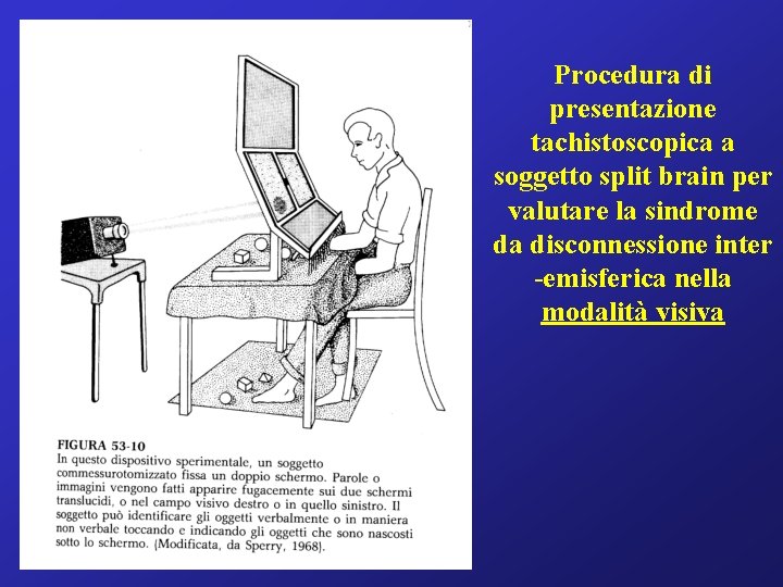 Procedura di presentazione tachistoscopica a soggetto split brain per valutare la sindrome da disconnessione