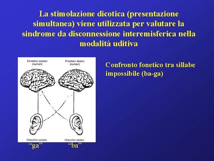 La stimolazione dicotica (presentazione simultanea) viene utilizzata per valutare la sindrome da disconnessione interemisferica