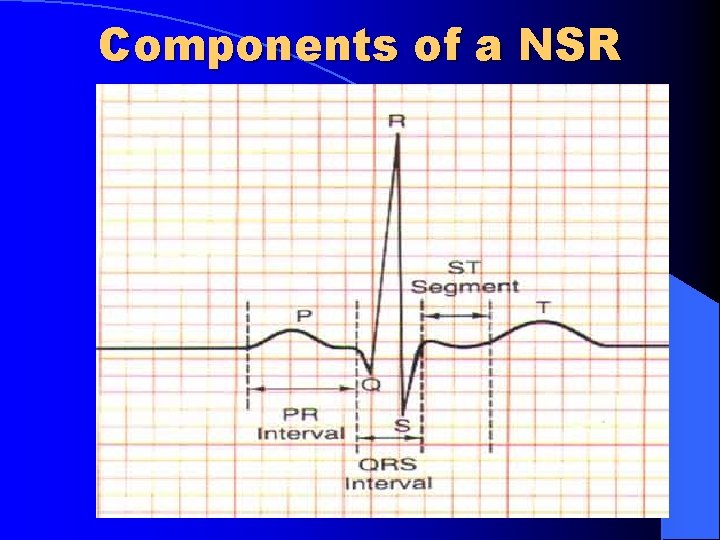 Components of a NSR 