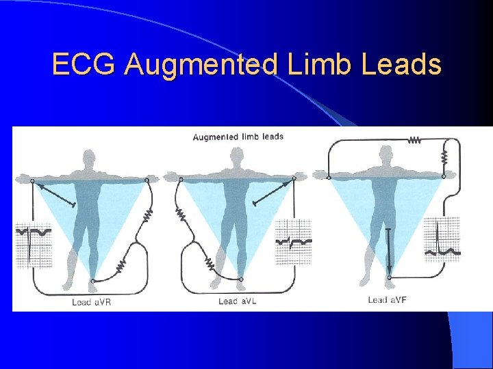 ECG Augmented Limb Leads 