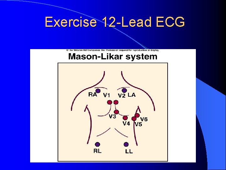 Exercise 12 -Lead ECG 