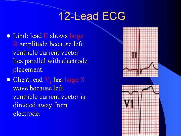12 -Lead ECG Limb lead II shows large R amplitude because left ventricle current