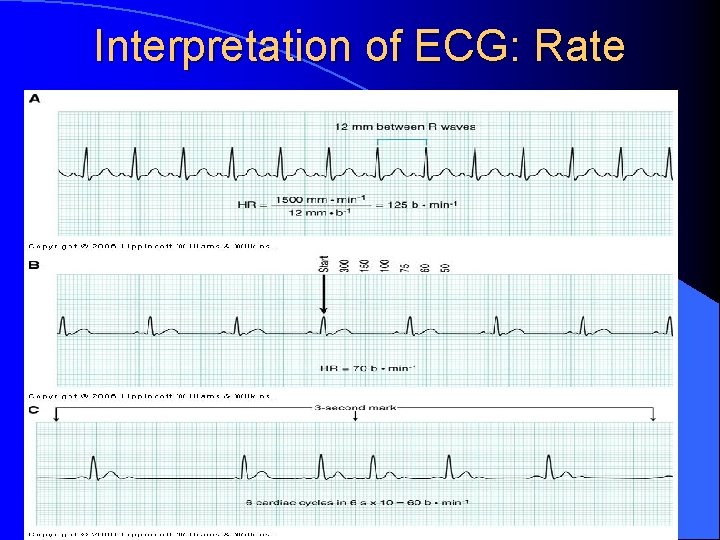 Interpretation of ECG: Rate 