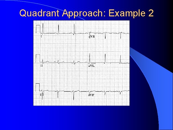 Quadrant Approach: Example 2 