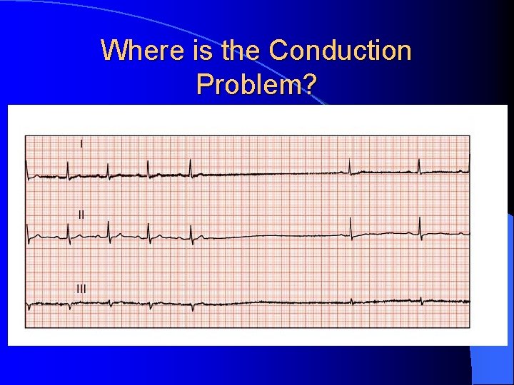 Where is the Conduction Problem? 