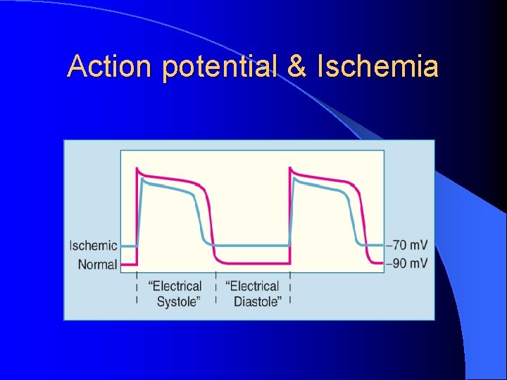 Action potential & Ischemia 