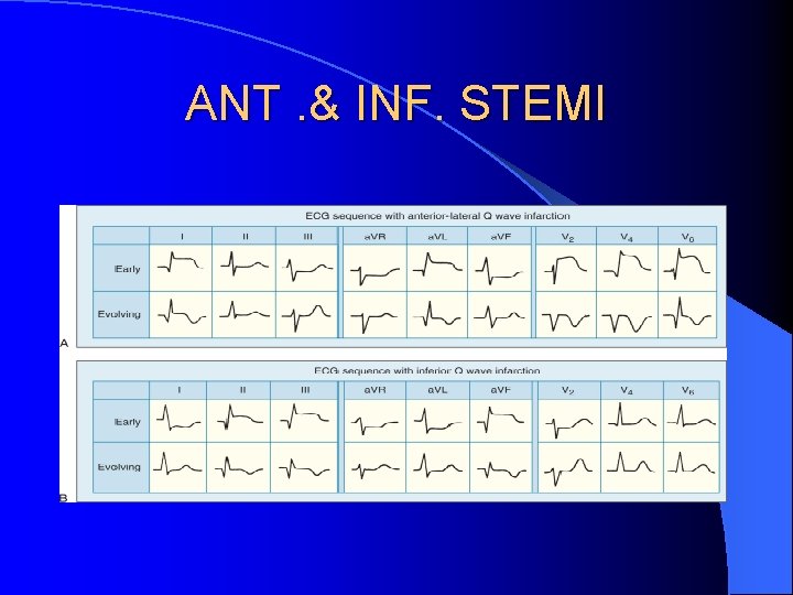 ANT. & INF. STEMI 