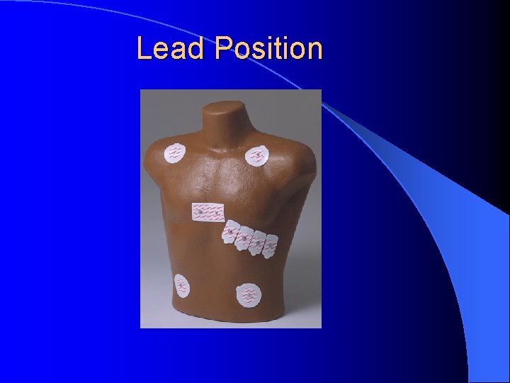 Lead Position 