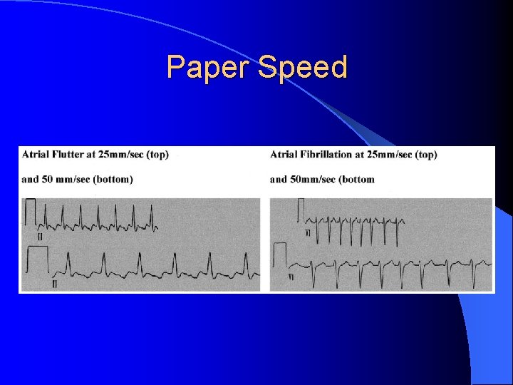 Paper Speed 