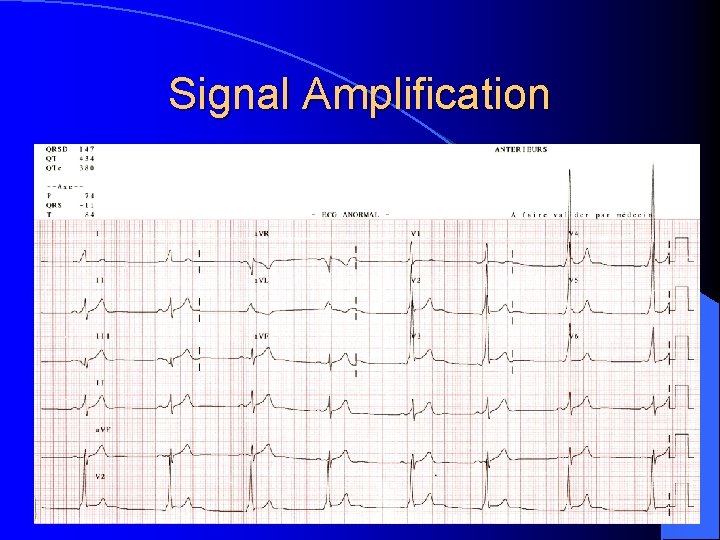 Signal Amplification 