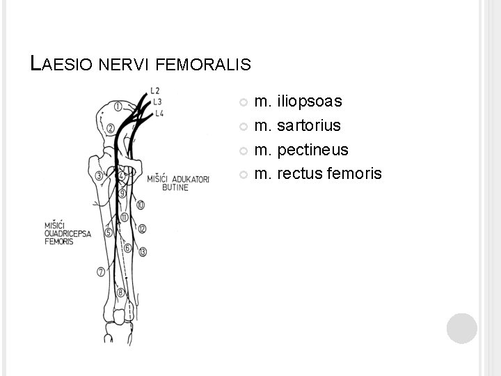 LAESIO NERVI FEMORALIS m. iliopsoas m. sartorius m. pectineus m. rectus femoris 