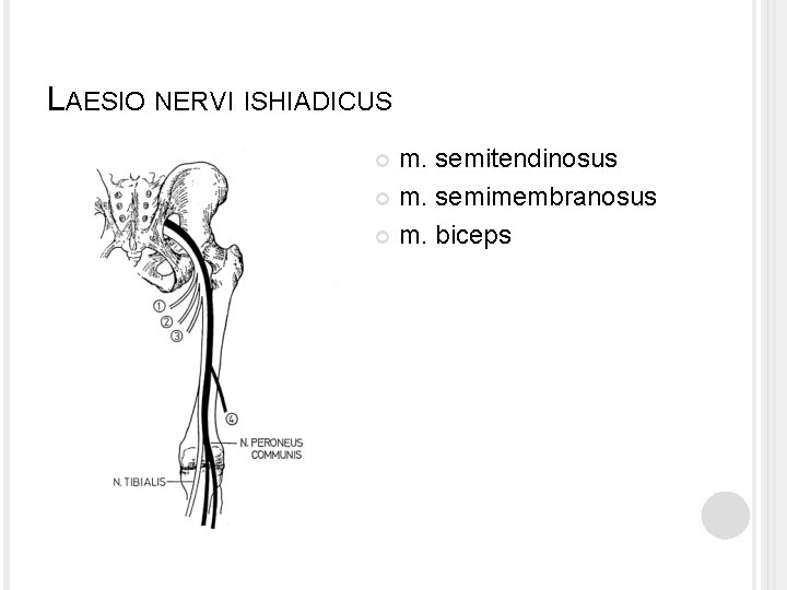 LAESIO NERVI ISHIADICUS m. semitendinosus m. semimembranosus m. biceps 