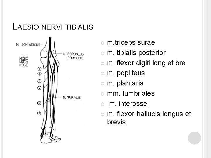 LAESIO NERVI TIBIALIS m. triceps surae m. tibialis posterior m. flexor digiti long et