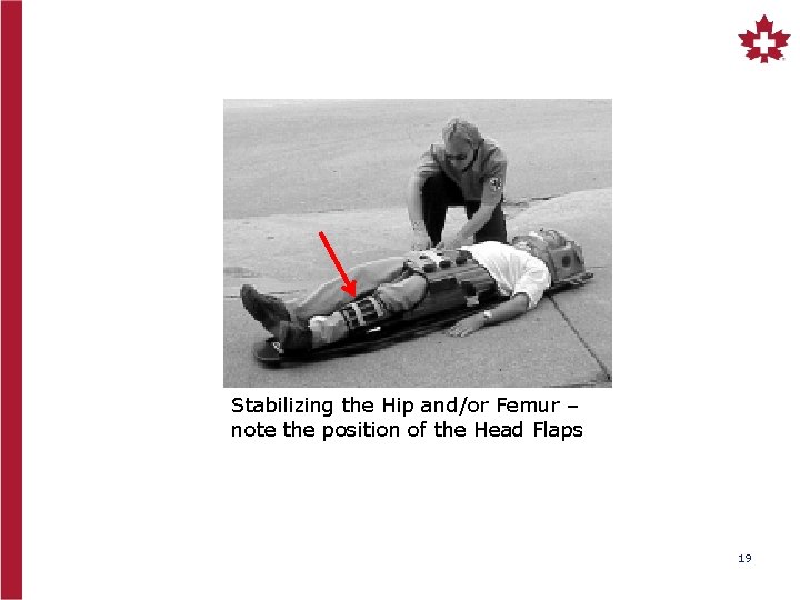 Stabilizing the Hip and/or Femur – note the position of the Head Flaps 19