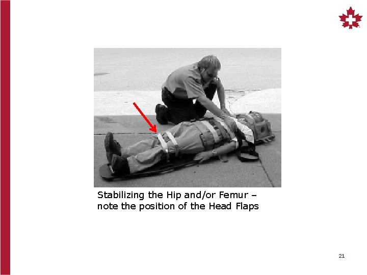 Stabilizing the Hip and/or Femur – note the position of the Head Flaps 21