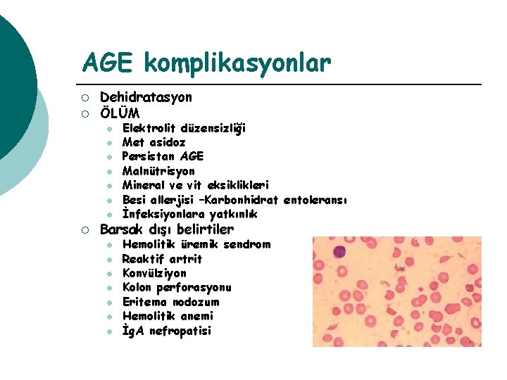 AGE komplikasyonlar ¡ ¡ Dehidratasyon ÖLÜM l l l l ¡ Elektrolit düzensizliği Met