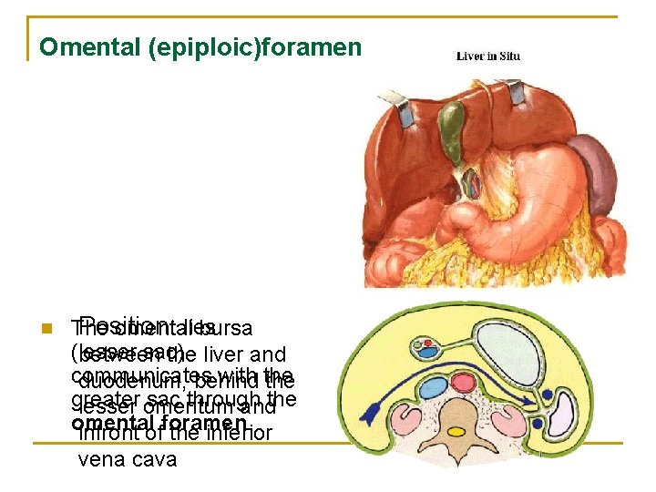 Omental (epiploic)foramen n Position: The omentallies bursa (lesser sac) between the liver and communicates