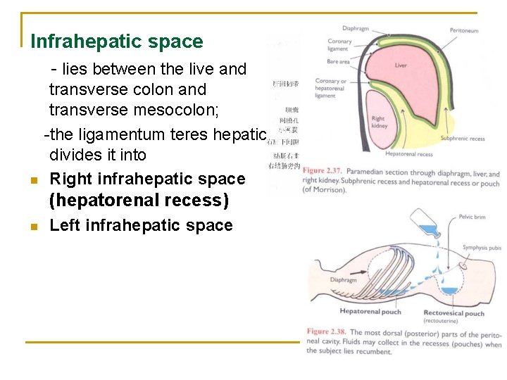 Infrahepatic space - lies between the live and n transverse colon and transverse mesocolon;