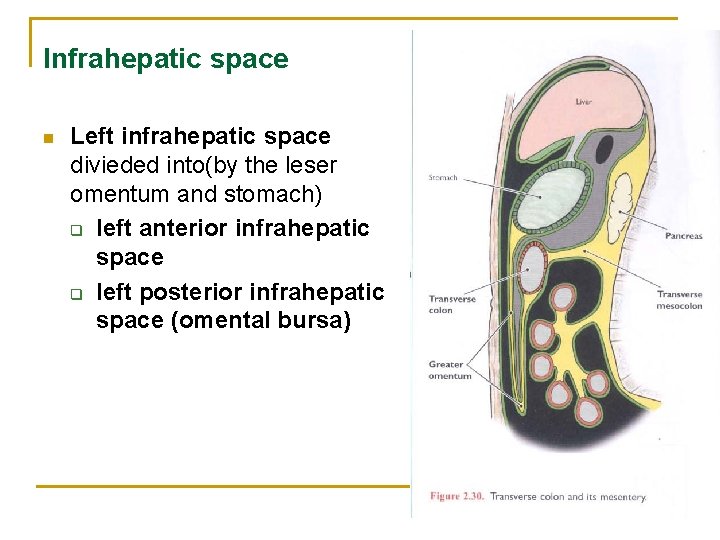 Infrahepatic space n Left infrahepatic space divieded into(by the leser omentum and stomach) q