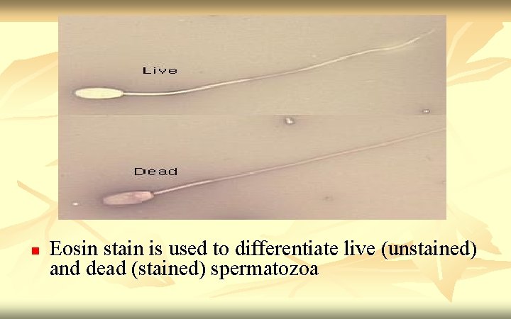 n Eosin stain is used to differentiate live (unstained) and dead (stained) spermatozoa 