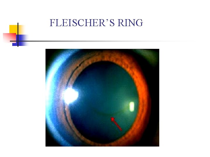 FLEISCHER’S RING 