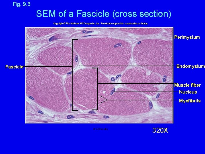 Fig. 9. 3 SEM of a Fascicle (cross section) Copyright © The Mc. Graw-Hill