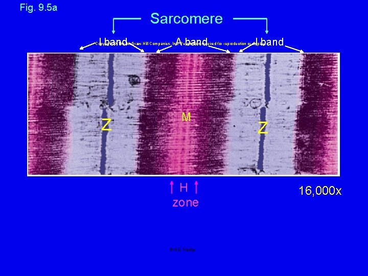 Fig. 9. 5 a Sarcomere I band A band I band Copyright © The