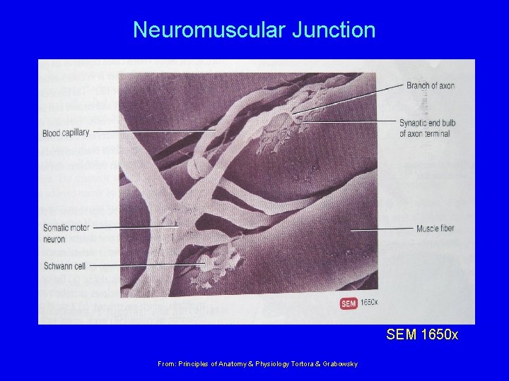 Neuromuscular Junction SEM 1650 x From: Principles of Anatomy & Physiology Tortora & Grabowsky