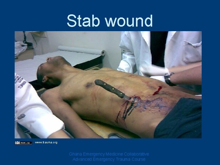 Stab wound www. trauma. org Ghana Emergency Medicine Collaborative Advanced Emergency Trauma Course 