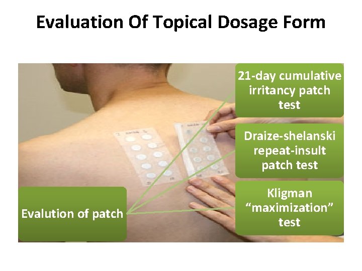 Evaluation Of Topical Dosage Form 21 -day cumulative irritancy patch test Draize-shelanski repeat-insult patch Evaluation Of Topical Dosage Form 21 -day cumulative irritancy patch test Draize-shelanski repeat-insult patch