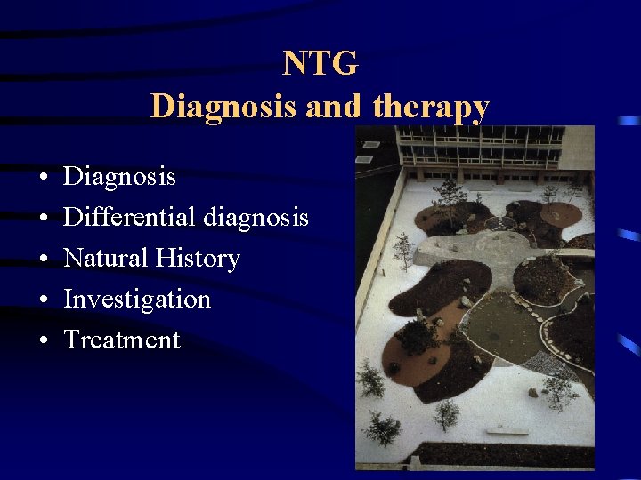 NTG Diagnosis and therapy • • • Diagnosis Differential diagnosis Natural History Investigation Treatment