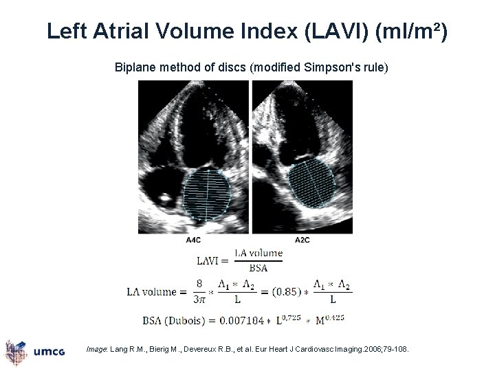 Left Atrial Volume Index (LAVI) (ml/m²) Biplane method of discs (modified Simpson's rule) Image: