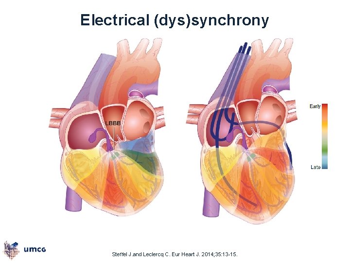 Electrical (dys)synchrony Steffel J. and Leclercq C. Eur Heart J. 2014; 35: 13 -15.
