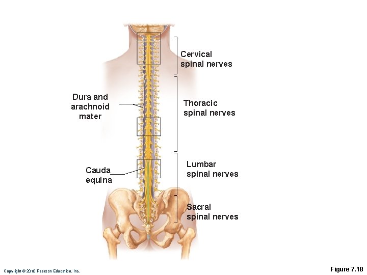 Cervical spinal nerves Dura and arachnoid mater Cauda equina Thoracic spinal nerves Lumbar spinal