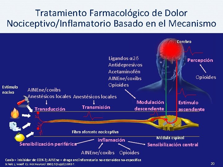 Tratamiento Farmacológico de Dolor Nociceptivo/Inflamatorio Basado en el Mecanismo Cerebro Estímulo nocivo Ligandos α