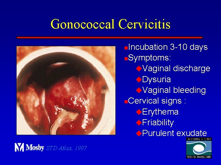 Gonococcal Cervicitis Incubation 3 -10 days n. Symptoms: u. Vaginal discharge u. Dysuria u.