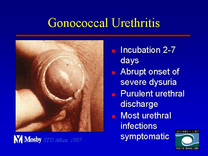 Gonococcal Urethritis n n STD Atlas, 1997 Incubation 2 -7 days Abrupt onset of