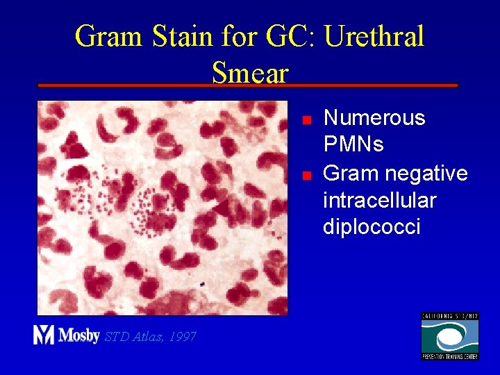 Gram Stain for GC: Urethral Smear n n STD Atlas, 1997 Numerous PMNs Gram