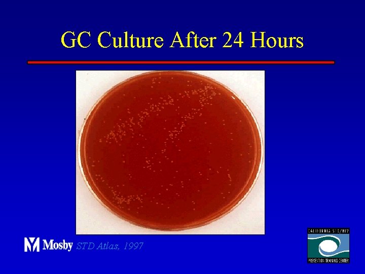 GC Culture After 24 Hours STD Atlas, 1997 