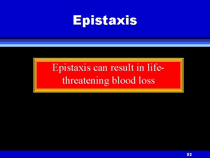 Epistaxis can result in lifethreatening blood loss 52 