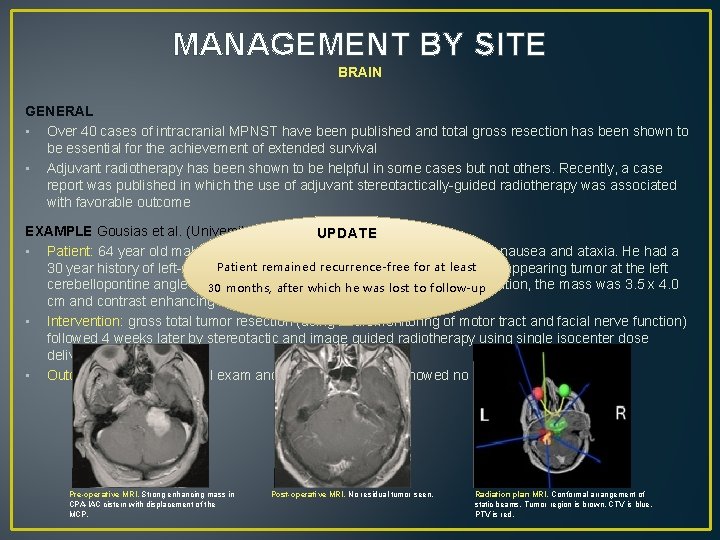 MANAGEMENT BY SITE BRAIN GENERAL • Over 40 cases of intracranial MPNST have been