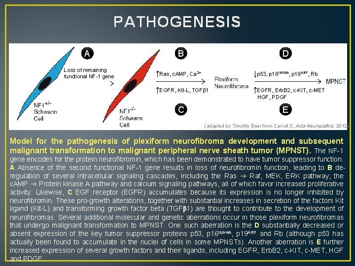 PATHOGENESIS A Loss of remaining functional NF-1 gene B D ↑Ras, c. AMP, Ca