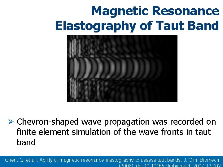 Magnetic Resonance Elastography of Taut Band Ø Chevron-shaped wave propagation was recorded on finite Magnetic Resonance Elastography of Taut Band Ø Chevron-shaped wave propagation was recorded on finite