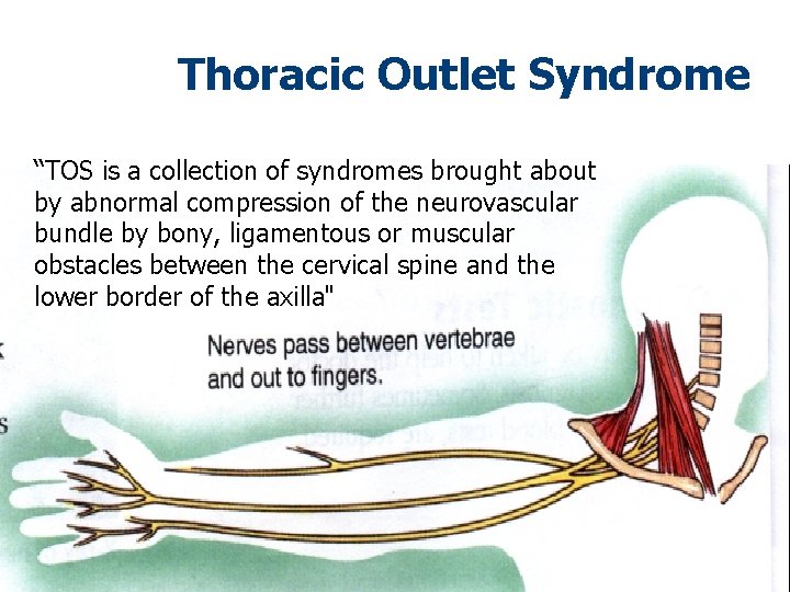 Thoracic Outlet Syndrome “TOS is a collection of syndromes brought about by abnormal compression Thoracic Outlet Syndrome “TOS is a collection of syndromes brought about by abnormal compression