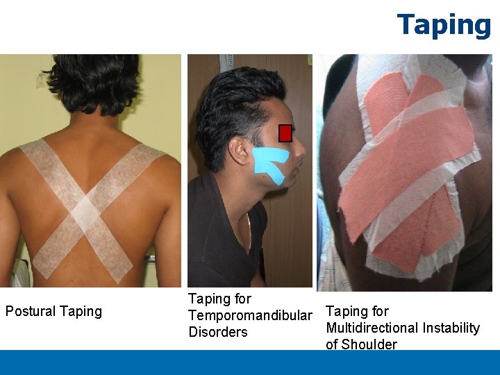 Taping Postural Taping Titlexx Taping for Temporomandibular Taping for Multidirectional Instability Disorders of Shoulder Taping Postural Taping Titlexx Taping for Temporomandibular Taping for Multidirectional Instability Disorders of Shoulder