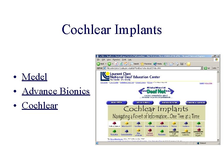 Cochlear Implants • Medel • Advance Bionics • Cochlear 