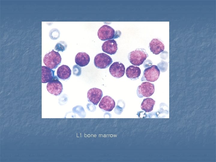 L 1 bone marrow 