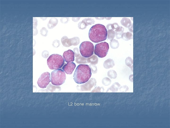 L 2 bone marrow 