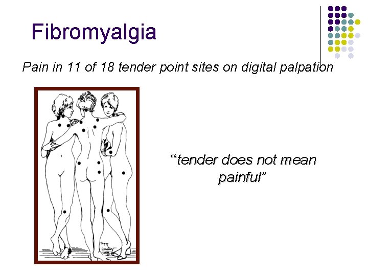 Fibromyalgia Pain in 11 of 18 tender point sites on digital palpation “tender does