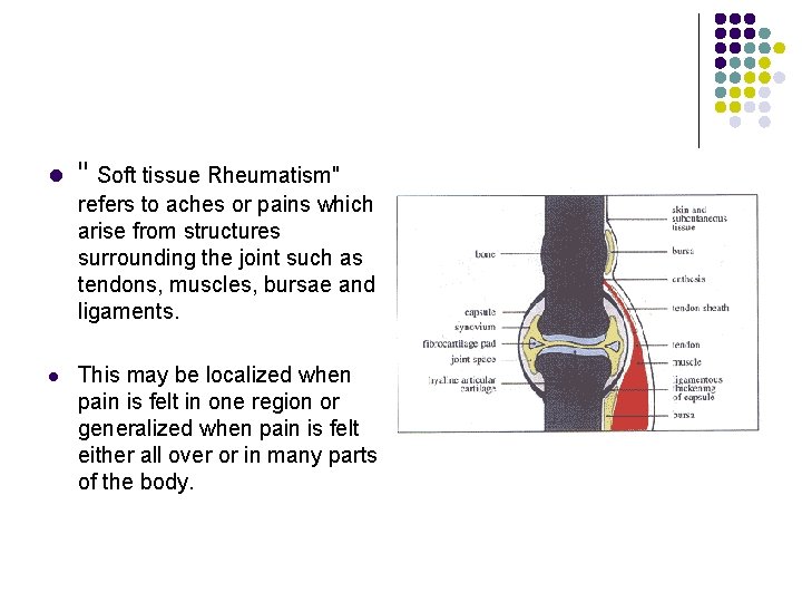 l " Soft tissue Rheumatism" refers to aches or pains which arise from structures